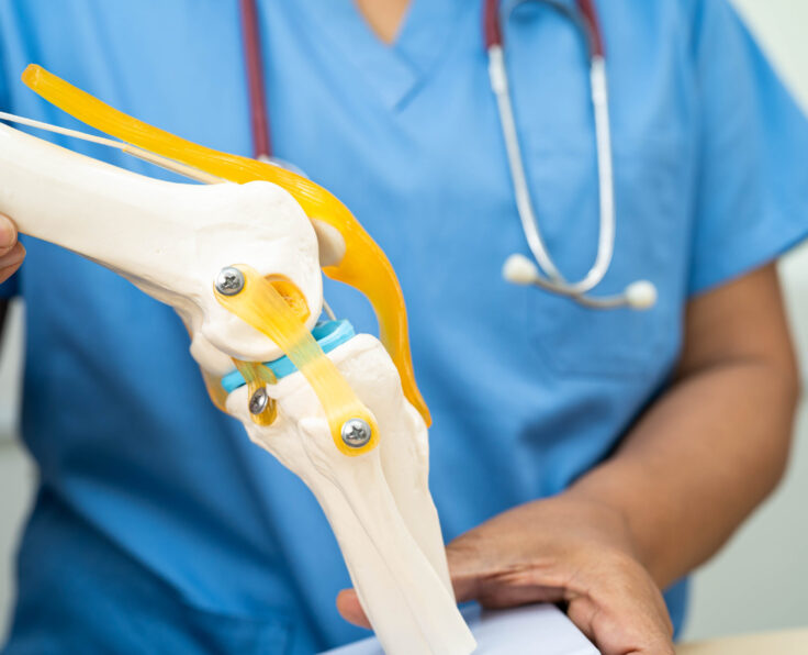 Asian doctor present knee joint model for elderly patient to surgery orthopedic.